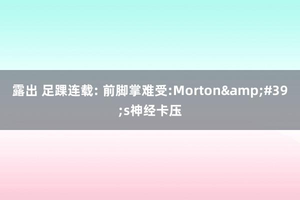 露出 足踝连载: 前脚掌难受:Morton&#39;s神经卡压